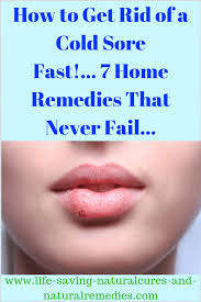 Best Natural Remedies Home Treatment Options For Fever Blisters Cold Sores Home Remedies For Fever Fever Blister Remedy Home Remedies Cold Sores