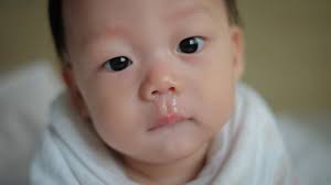 Selain kesulitan bernapas, hidung yang mampet kadang kala juga menyebabkan. 10 Petua Hilangkan Kahak Bayi Mama Boleh Cuba Dalam Rumah