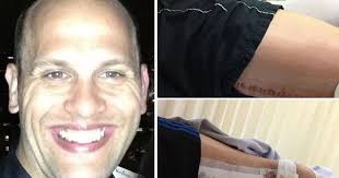 Doctors misdiagnosed his cancer as pulled MUSCLE