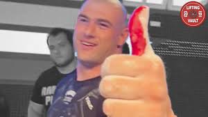 This Was Dannys Thumb BEFORE The 500 kg Attempt