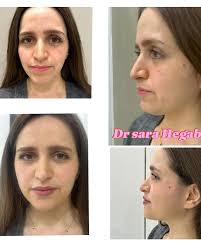 Dr Sara Hegab (@dr_sarahegab) • Instagram photos and videos