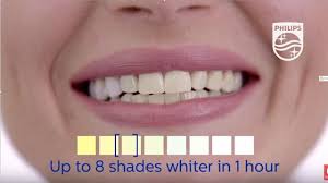 All the time is necesary to put a barrier in the gums to protect it. Zoom Teeth Whitening Philips Dental Professionals Youtube