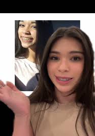 Why Does Aisha Sofey Have Braces