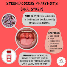 Image result for Strep throat infection roof of mouth