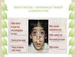 Zespół aspergera należy do uogólnionych zaburzeń rozwojowych (do tej grupy zalicza się także autyzm, za którego łagodniejszą odmianę kiedyś go uważano). Zaburzenia Rozwojowe Zespol Fas I In Zespol Aspergera Pdf Free Download