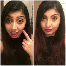 This can include acne melasma usually covers a larger area of skin than other types of hyperpigmentation, and it. Cover Your Dark Circles Without The Grey Under Your Eyes Little Legs Big Steps