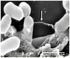 Viewing a human parasite under the microscope is observing an organism that lives in (or on) another living organism (host) for survival. Scanning Electron Microscope Image Of Listeria And Extracellular Material