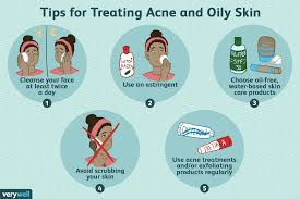 treatment tips for oily skin and acne