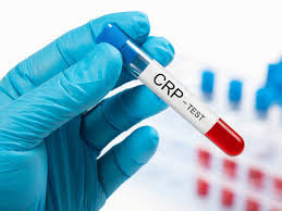 Use glovo and you'll receive your order at your door, quickly and easily. Coronavirus Covid 19 Treatment What Is A Crp Test And Who Should Get It Done