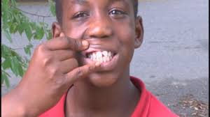 Albany mother wants answers about son's chipped tooth