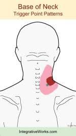 Pin On Neck Pain