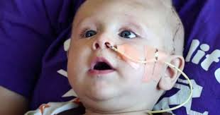 Child with brain outside skull defies doctors' predictions (Photo, +16)