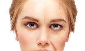 We did not find results for: Eyelid Turning The Wrong Way