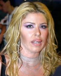 Nella puntata del 19 settembre a unomattina magazine è andato in onda un servizio sù loredana lecciso e albano carrisi e il loro matrimonio. Irriconoscibile Loredana Lecciso Prima E Dopo Il Botox Capelli Biondo Platino Viso Tirato E Labbroni Cosi Siamo Abituati A Vedere L Ex Lady Carrisi Ma Dal Passato Spunta La Foto Che La Incastra