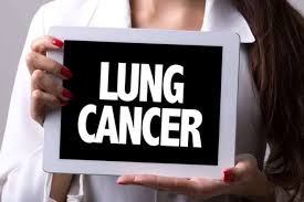 Research estimates that 93% of lung cancers in nonsmokers are adenocarcinoma. World Lung Cancer Day 2020 60 Year Old Noida Woman Hit By Cricket Ball Diagnosed With Lung Cancer The Financial Express