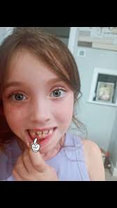 We take “pinky promises” very seriously around here. This cutie understood  the assignment when she locked fingers with Dr. Luce and promised to get  out her Luce Tooth! Great Job!!! ✨🦷✨