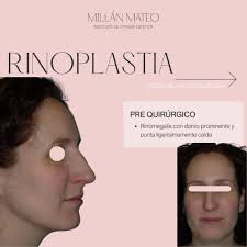 Profile for Dr. Millán Mateo