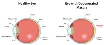 Macular Degeneration Milwaukee Eye Examination Mequon