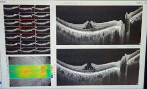 Image result for Incidental Imaging Finding