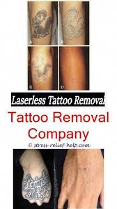Laserless tattoo removal helps in removing that dreadful tattoo that you want removed from your body quire easily. How Hard To Remove A Tattoo Finger Tattoo Removal Cost Free Gang Tattoo Removal Tattoo Removal 7786789329 New Tattoos Kinder Tattooentfernung Erstes Tattoo