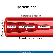 Non a caso le problematiche della pressione alta affliggono oltre il 20% della. Ipertensione Che Cos E Tipologie Cause Dieta E Valori