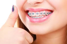 Listen to do it yourself braces by dr. The Braces Survival Kit What You Should Always Keep On You Fowler Orthodontics