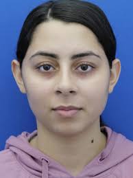 Ridge Formation and Setback 6393