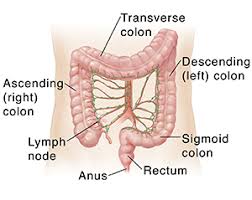 Other treatments, such as radiation therapy and chemotherapy, might also be recommended. What Is Colon And Rectal Cancer Colorectal Cancer Saint Luke S Health System