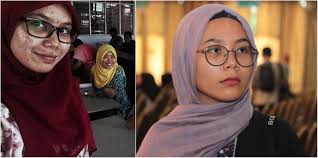 Kalau yang bagus ni selalunya harga mencecah ratusan ringgit. Dari Muka Jerawat Berjemaah Kini Kulit Gadis Ini Jadi Licin Flawless Apa Rahsianya