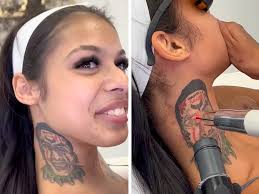 Island Boys’ Franky Venegas Ex-GF Removing Tattoos of Him After His Arrest