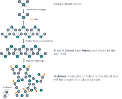 The Clinical Use Of A D Dimer Assay