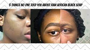 What is black soap good for. 5 Things No One Told You About Raw African Black Soap Chastityxo Youtube