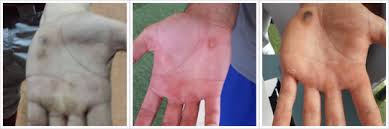 Image result for Hamate Bone