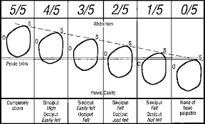 preventing prolonged labour ii 5 observations charted on