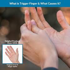If You Wake Up With Your Finger Stuck In A Bent Position Feel A Pop When You Try To Straighten It Or Have To U In 2020 Trigger Finger How To
