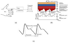 Os developers have latitude for mixing and matching scheduling strategies. Sensors Free Full Text Human Vital Signs Detection Methods And Potential Using Radars A Review Html