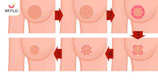 Big Areolas: Your Guide to Understanding Different Areola Sizes | MyloFamily