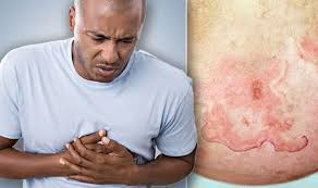Maybe you would like to learn more about one of these? Heart Attack Symptoms Signs Of Heart Disease Include Rash On Your Skin Common Symptoms Express Co Uk