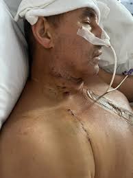 Fundraiser by Vicky Gonzalez : Support Michael's Journey to Vital Heart  Surgery