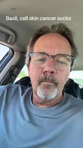 Barbara Oneill Basal Cell Carcinoma