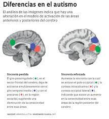 Sindrome de asperger, aspergers and high functioning autism. Otra Causa Posible Del Autismo Revista Pesquisa Fapesp