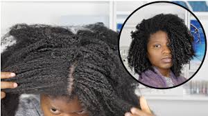 Dandruff is a specific form of seborrheic dermatitis that is confined to the scalp. Getting Rid Of Dandruff And Flakes For Type 4 Natural Hair Ft As I Am Dry Itchy Scalp Care Youtube