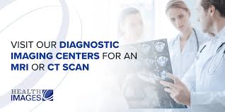 The average ct scan price without insurance can range from $1,016 to $1,440. Average Cost Of Cat Scan Without Insurance