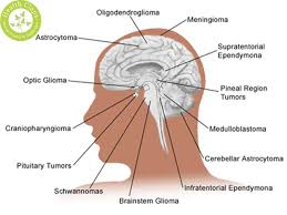 Pin On Diseases