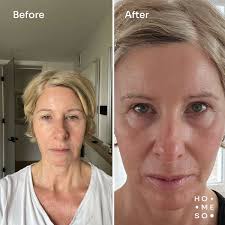 product_data_13933_meta_title