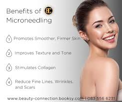 ✨ Microneedling Benefits You'll Love! ✨ Did you know microneedling helps  with acne scars and pigmentation? Discover the benefits today! 639 Edgar  Street, Garsfontein marguerite@hershensohn.com +27 83 556 6231 Book Now:  beauty-connection.booksy.com #