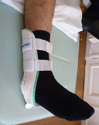 Elle se produit souvent après torsion du pied. Entorse De La Cheville Specialiste De La Chirurgie De L Epaule Chirurgie Du Genou A Paris