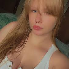 Support groups for children with cleft lip and palate?