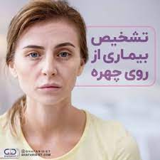Vici g, belli l, biondi m, polzonetti v. Ø±Ú˜ÛŒÙ… Ù„Ø§ØºØ±ÛŒ Ø¨Ù‡Ø§Ø±Ù‡ ØºÙØ§Ø±ÛŒ