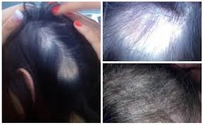 Prevent hair loss stabilize hair root ,grow hair, balance scalp environment. Fda Issues Safety Alert For Hair Conditioner After Record Number Of Complaints Fox 5 San Diego